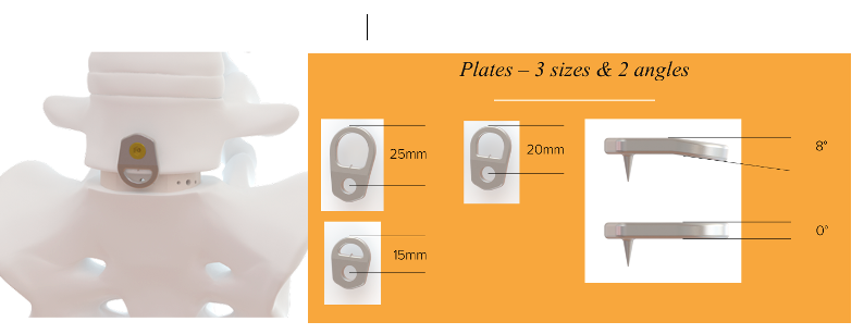 boundary® Buttress Plating System (Prod 2406244)